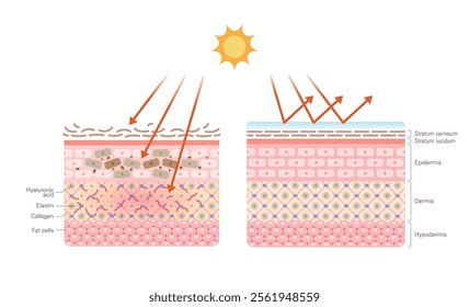 The changes of skin structure damaged by sunlight(before and after comparison). Skin layer vector illustration. Skin anatomy. Epidermis diagram