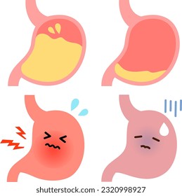 Characters of hyperacid stomach and low stomach acid stomach