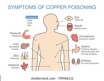 Chart of the Main Symptoms of Copper Poisoning. Illustration about medical diagram.