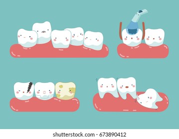 Check up decayed tooth , Wisdom tooth of dental set