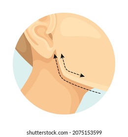 Cheekbone correction cosmetic surgery procedure of female face with dotted lines. Plastic surgery vector illustration