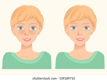 Cheerful cute young girl with freckles and same girl  without freckles. Concept for whiten skin and remove freckles, dark spots and sunspots. Vector illustration.