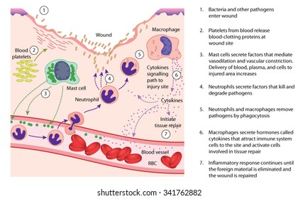 Chemical And Cellular Factors Involved In The Inflammatory Response To Tissue Damage And Repair.