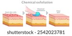 Chemical exfoliation section. Face, body serums,  creams, Ahas, face smoother. Skin care, old dead cells. Before, after. Vector illustration