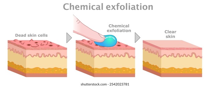 Chemical exfoliation section. Face, body serums,  creams, Ahas, face smoother. Skin care, old dead cells. Before, after. Vector illustration