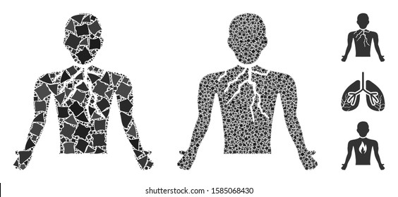 Chest cancer icon composition of bumpy pieces in different sizes and color hues, based on chest cancer icon. Vector bumpy dots are combined into composition.