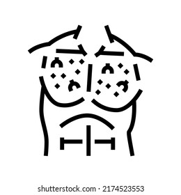 chest ingrown hair line icon vector. chest ingrown hair sign. isolated contour symbol black illustration