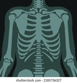 Chest roentgen, x ray scan of patient with respiratory diseases. Hospital and clinics healthcare and treatment of illnesses, diagnostics and analysis of results. Vector in flat style illustration