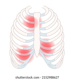 chest wall muscle rib fracture broken acute pain tietze syndrome bone joint tract  deep breath or cough strain Virus bacteria Tumor Cancer overuse