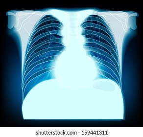 chest x-ray. vector