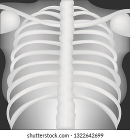 Chest X-rays medical vector illustration.