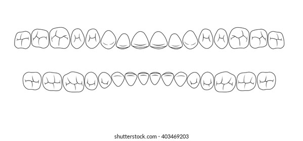 chewing surface of teeth, fissures