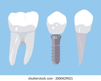 Chewing tooth, denture and incisor