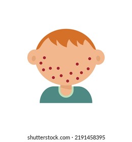 Chicken pox kid boy icon. Flat illustration of chicken pox kid boy vector icon isolated on white background