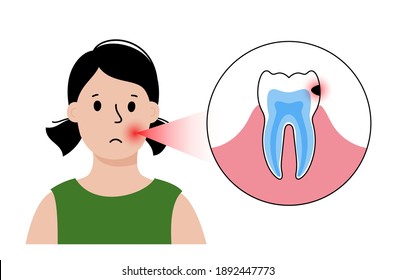 Child Dental Care Concept. Girl In Stomatology Clinic, Toothache Problem. Tooth Anatomy Isolated Flat Vector Illustration. Oral Hygiene Medical Poster. Medicine Diagnosis, Treatment For Teeth Disease.