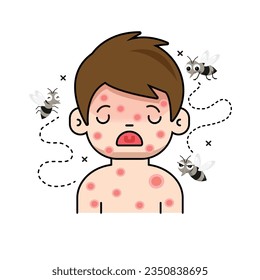 El niño tiene erupciones rojas en su cuerpo. Por ser picado por un mosquito a la fiebre del dengue. 