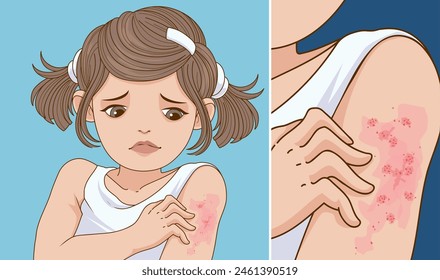 The child is itching. Skin disease. Itching, scabies. Healthcare illustration. Vector illustration. 