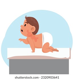 niño con Miliaria, calor espeso, problemas de piel en un bebé. ilustración vectorial.