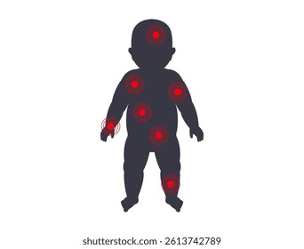 Child silhouette with red spots symbolizing pain, infection, or skin condition. Pediatric medical baby diagram showing illness, discomfort, inflammation, or viral disease, flat vector illustration