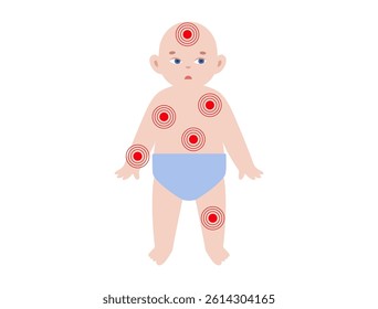 Child silhouette with red spots symbolizing pain, infection, or skin condition. Pediatric medical baby diagram showing illness, discomfort, inflammation, or viral disease, flat vector illustration