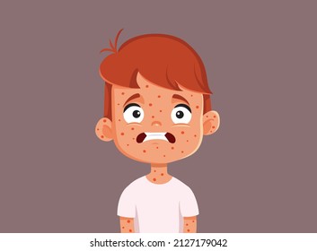 
Child Suffering from Measles Vector Cartoon Illustration. Little kid getting a viral disease suffering from the symptoms
