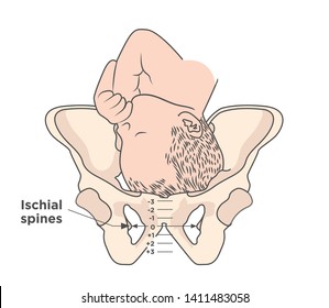 Child in womb - pelvis ischial spines medical illustration