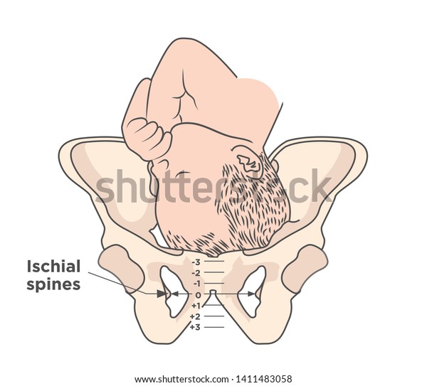 胎内の子ども 骨盤の坐骨棘の医療イラスト のベクター画像素材 ロイヤリティフリー