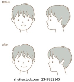 Children's faces with opposite occlusion, before and after orthodontic treatment