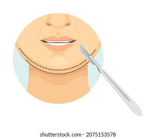 Chin correction procedure, cosmetic surgery on female face with dotted lines. Plastic surgery vector illustration