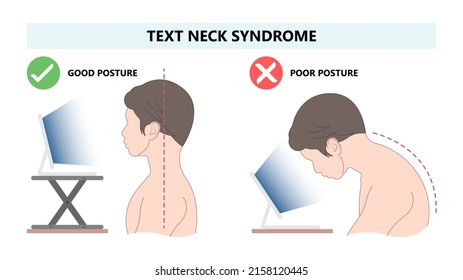 Chin Tuck Head Text neck lift pain nerve deep flexor spine inflamed bad correct poor good phone smart tablet laptop use work from home chiropractor strain upper back Jaw Joint outlet stress injury