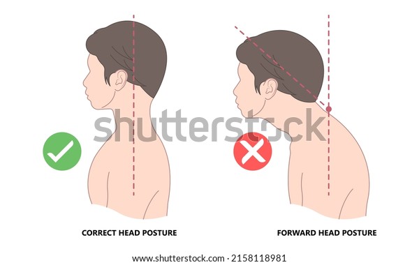 Chin Tuck Head Text neck lift pain nerve deep
flexor spine inflamed bad correct poor good phone smart tablet
laptop use work from home chiropractor strain upper back Jaw Joint
outlet stress injury