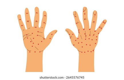 Acupuntura chinesa. Anatomia humana. Ilustração vetorial da mão direita humana. Palm e parte de trás da mão. Terapia sujok e acupuntura
