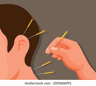 Chinese traditional acupuncture cartoon illustration vector