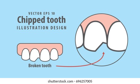 Chipped tooth illustration vector on blue background. Dental concept.