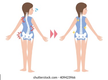 chiropractic before after image, from bad posture to good posture, woman's body and backbone, vector illustration