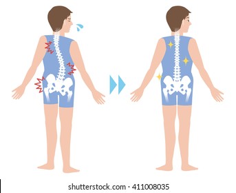 chiropractic before after image, from bad posture to good posture, man's body and backbone, vector illustration