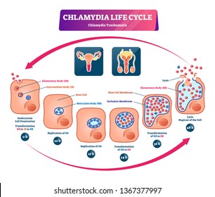 Chlamydia life cycle vector illustration. Labeled STI infection development diagram. Sexually transmitted medical problem scheme. Microbiological educational structure with cells, membrane and lysis.