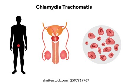 Chlamydia Trachomatis. Woman’s and man's reproductive system infections. Medical disease 