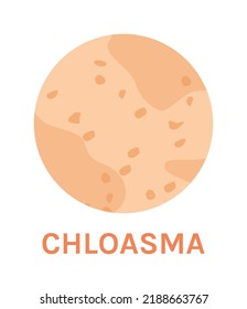 Chloasma. A Skin Problem and Disease. Pigmentation and Freckles on Human Skin. Melasma in Close up. Zoom. Circle Icon. Color Image. Vector illustration for Medical Design.