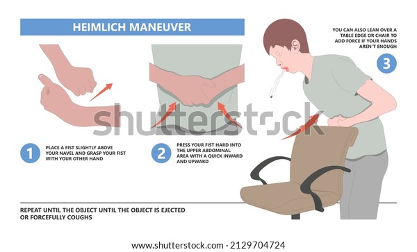 Choking first aid baby food CPR child\
step lodges blocking victim adult help abdomen kids conscious\
poster swallow back blows chest rescue breath care\
safety