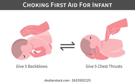 Choking First Aid For Infant cartoon illustration . Back blows and switch with chest thrusts . Flat design . Vector .
