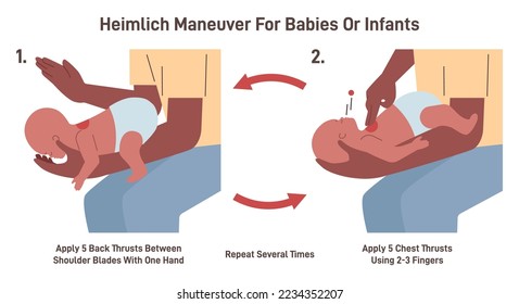 Choking first aid for an infant. Heimlich maneuver procedure to remove a foreign object from baby airways. Hands position and actions instruction. Flat vector illustration