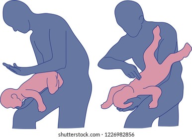 Choking First Aid. Vector.