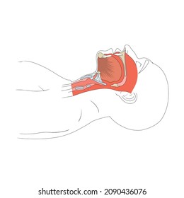 1,244 Airway opening Images, Stock Photos & Vectors | Shutterstock