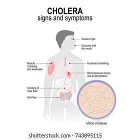 cholera bacteria diagram