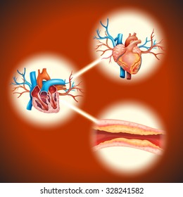 Cholesteral in human heart illustration