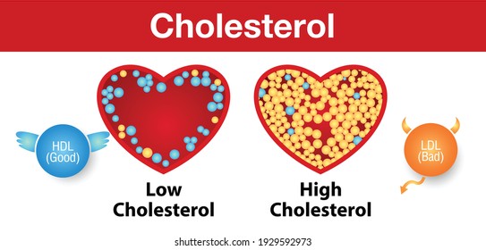 Cholesterol in artery, health risk , vector design.