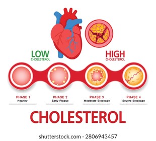 Cholesterol in artery, health risk , vector design