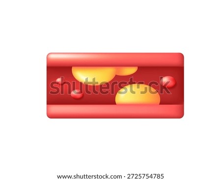 Cholesterol concept. 3d vector illustration of blood vessels with accumulated fat. Fatty plaques. Blood flow obstructed by cholesterol. Fat deposits. 3D style design. White background.