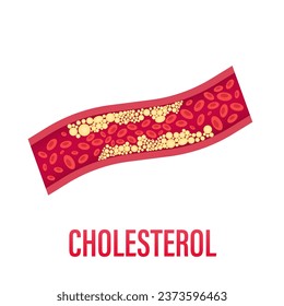 Cholesterol flat icon. Color simple element from nutrition collection. Creative Cholesterol icon for web design, templates, infographics and more. Healthcare concept. Vector illustration